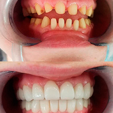 Китай хэйхэ лечение зубов